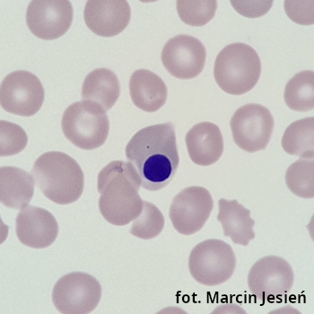 Erytroblast kwasochłonny