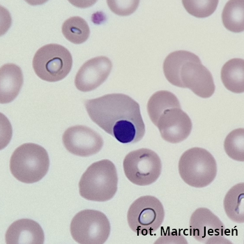 Erytroblast kwasochłonny
