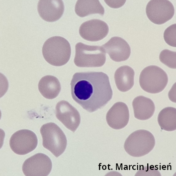 Erytroblast kwasochłonny