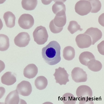 Erytroblast kwasochłonny