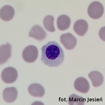 Erytroblast kwasochłonny