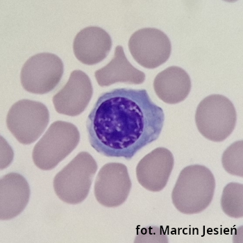 Erytroblast polichromatofilny