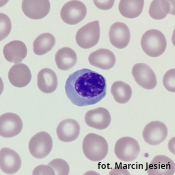 Erytroblast polichromatofilny