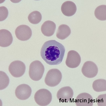 Erytroblast polichromatofilny