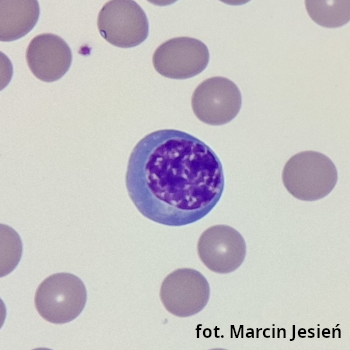Erytroblast polichromatofilny
