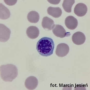 Erytroblast polichromatofilny