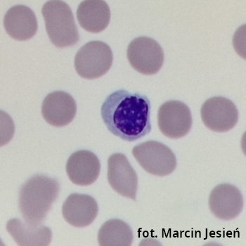 Erytroblast polichromatofilny