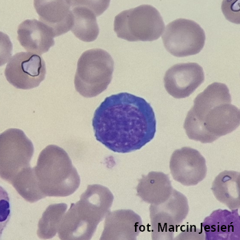 Erytroblast zasadochłonny