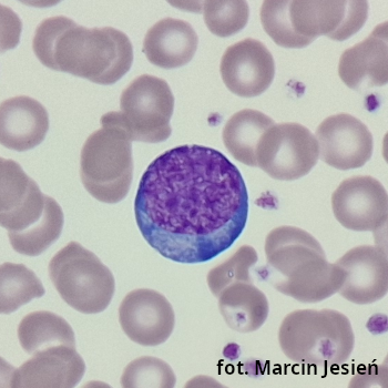 Erytroblast zasadochłonny