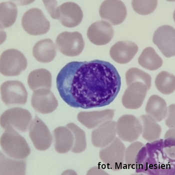 Erytroblast zasadochłonny