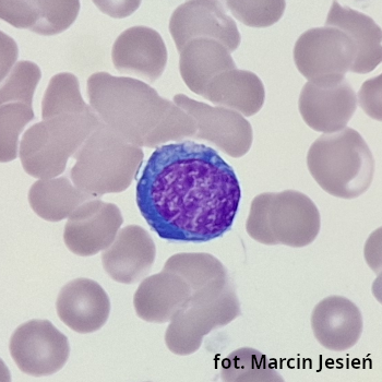 Erytroblast zasadochłonny