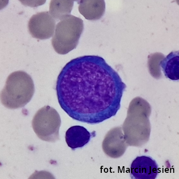 Erytroblast zasadochłonny